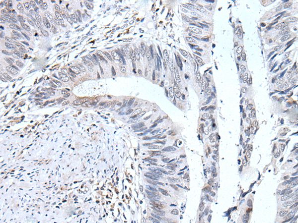UBE2T Antibody