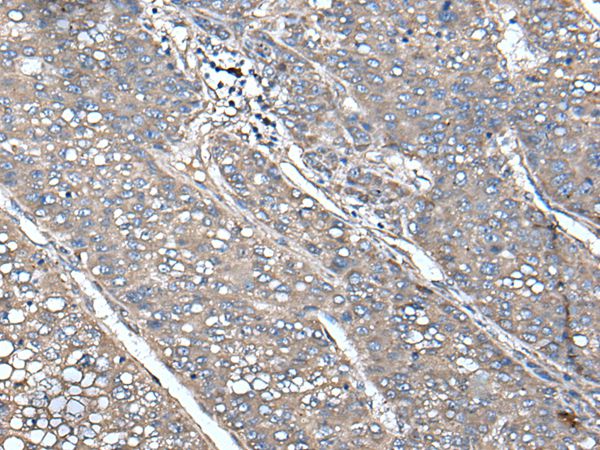 UNC13B Antibody