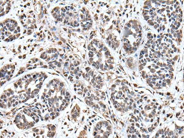 UPK3A Antibody