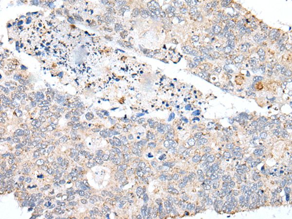 PDCD6IP Antibody