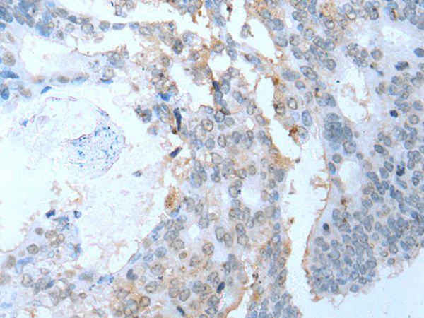 SYCP2 Antibody