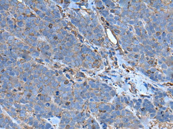 SLC24A5 Antibody