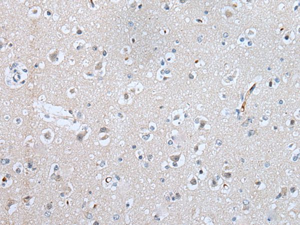 SLC5A10 Antibody
