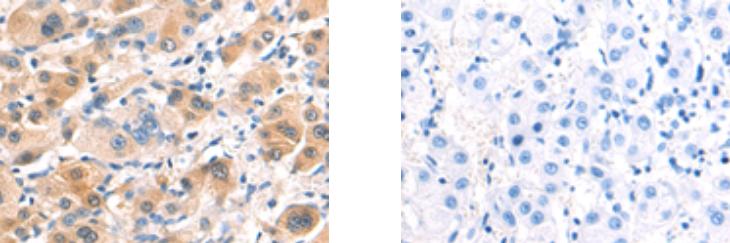CLDN6 Antibody