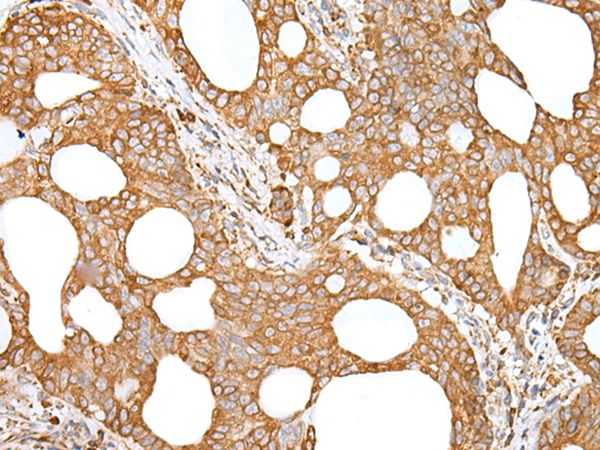 GANAB Antibody