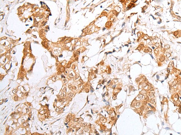E2F3 Antibody