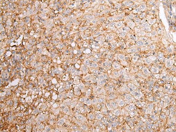 EFNA4 Antibody