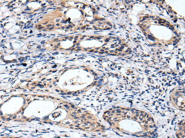 GTSE1 Antibody