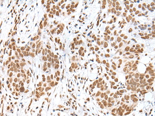 HCN3 Antibody