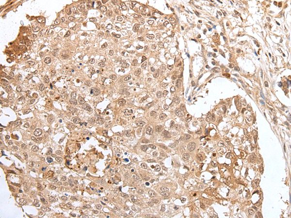 HOXA3 Antibody