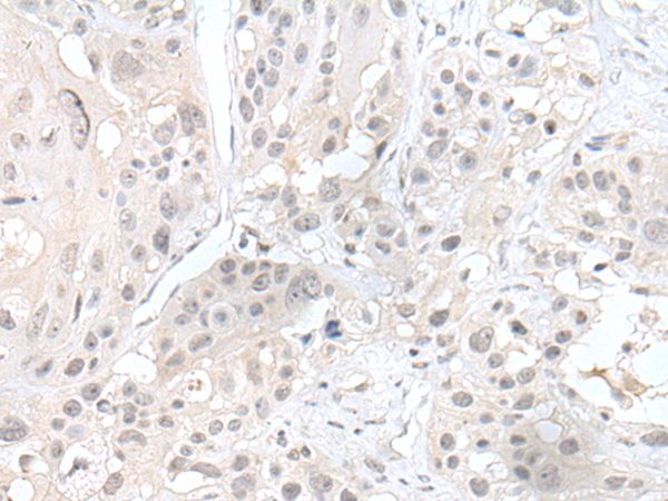 HDAC4 Antibody