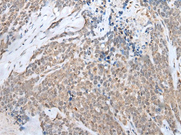 HOXB7 Antibody
