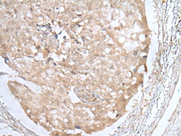 HOXD3 Antibody
