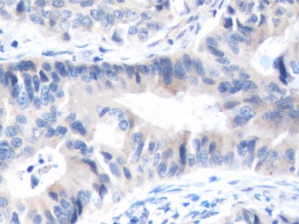 PTPRG Antibody