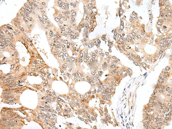 CASC5 Antibody