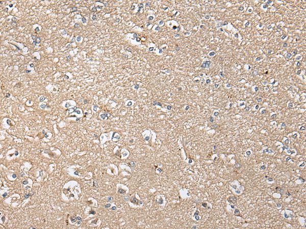 KLHL4 Antibody