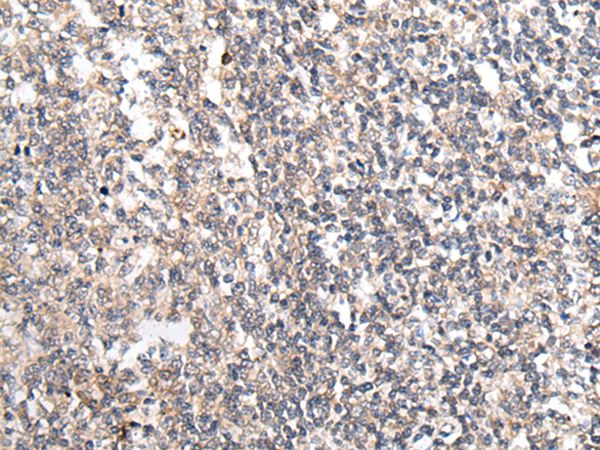 MT-ND5 Antibody