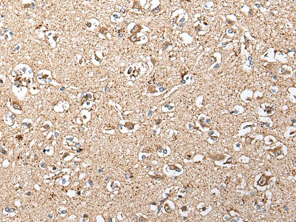 SLC12A3 Antibody