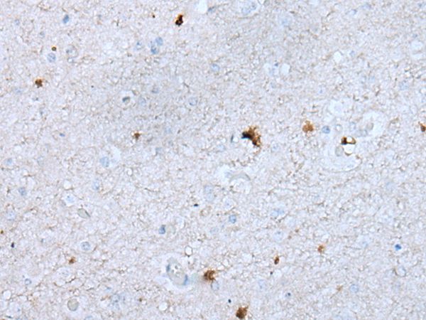GAS2L1 Antibody