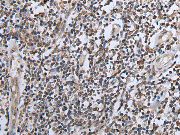 CXCL6 Antibody