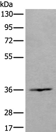 HOXD10 Antibody