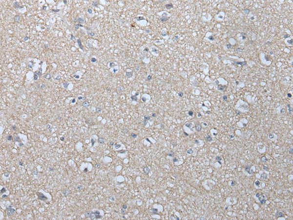 MAGEB1 Antibody