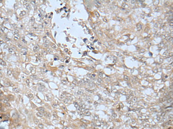 LRRC23 Antibody