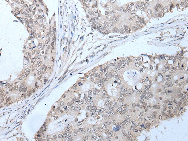 PPP1R42 Antibody