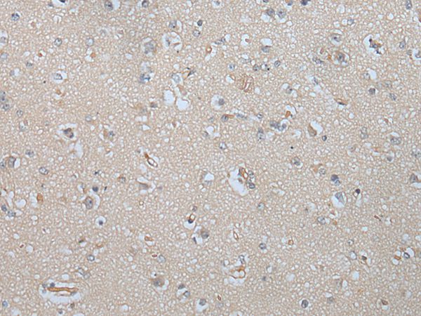 MAGEB5 Antibody