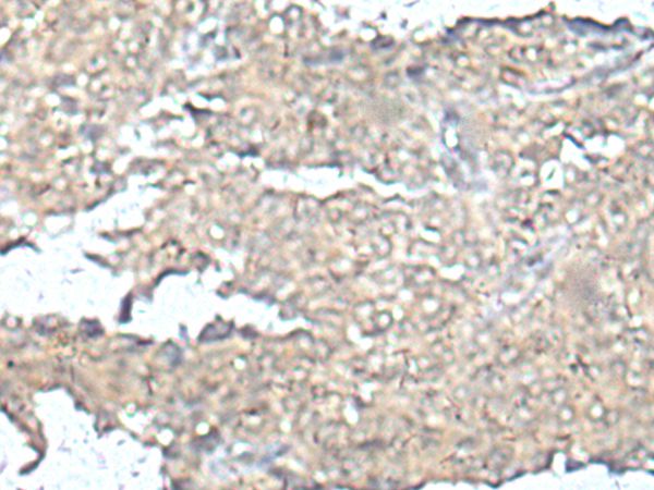 MEF2D Antibody