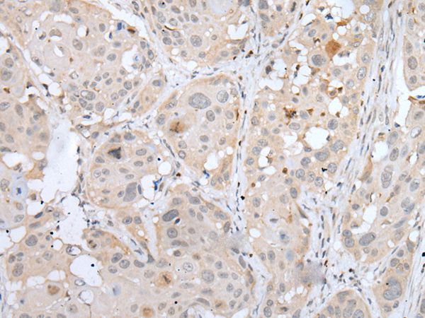 MEF2BNB Antibody