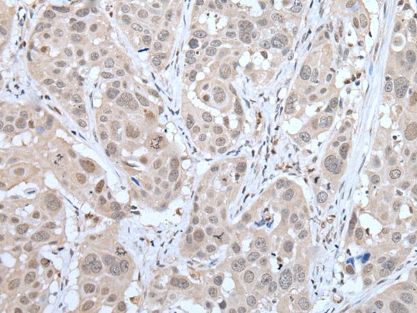 MTA3 Antibody
