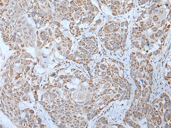 LHCGR Antibody