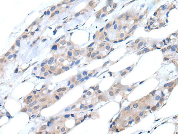 PIK3CA Antibody