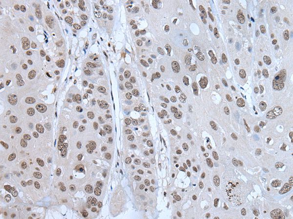 HAND1 Antibody