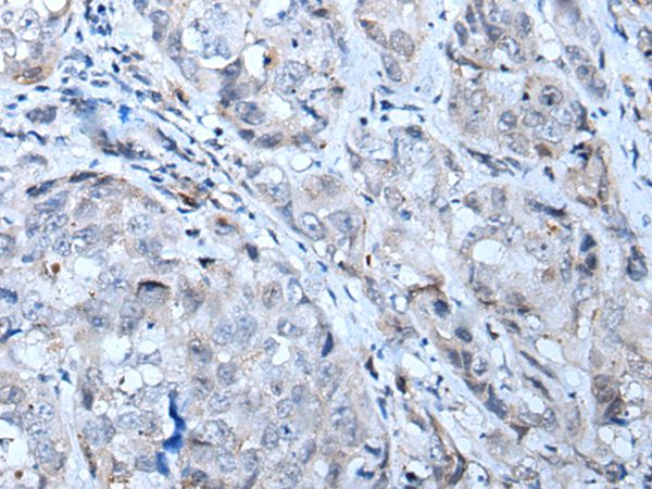 CTR9 Antibody