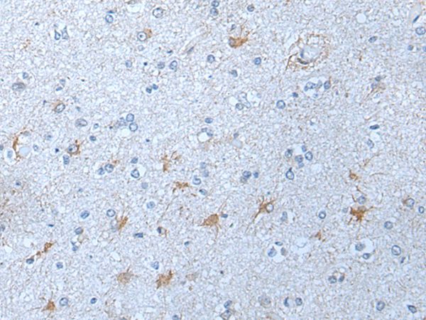 KLK12 Antibody
