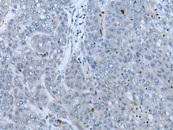 NF1 Antibody