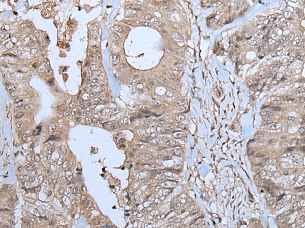 NUP88 Antibody
