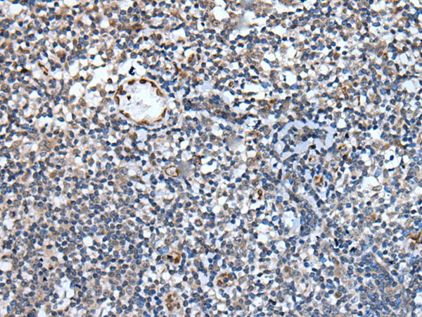 PAPPA-AS1 Antibody