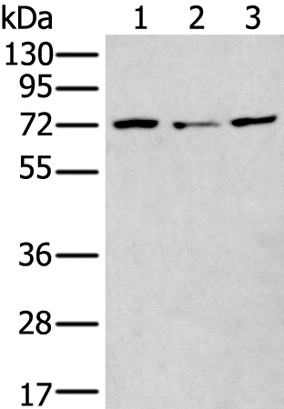 MTHFR Antibody