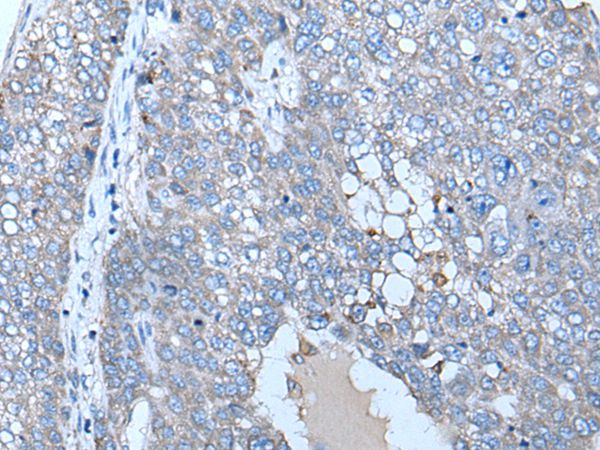 ZC3HAV1 Antibody