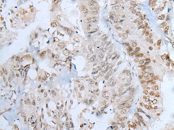 ZNF143 Antibody