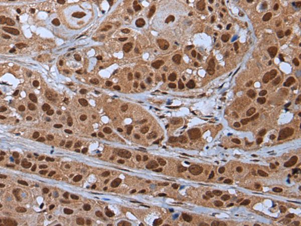 YY2 Antibody
