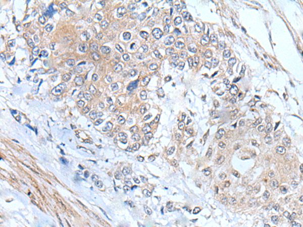 MIEN1 Antibody