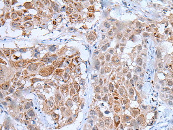WDHD1 Antibody
