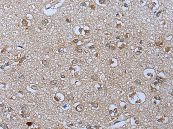 PYM1 Antibody