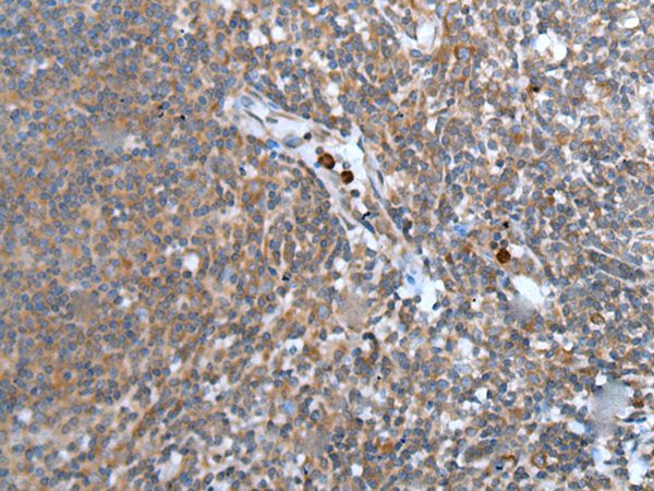 WISP2 Antibody