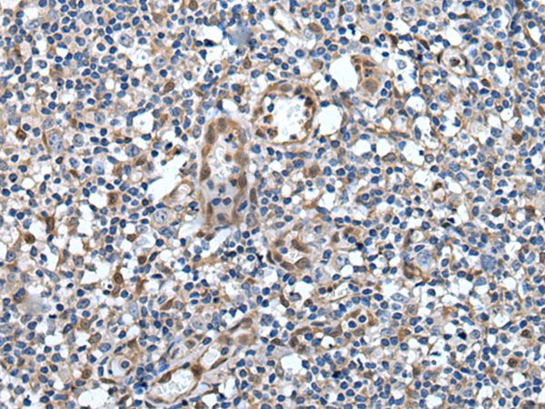VAX1 Antibody