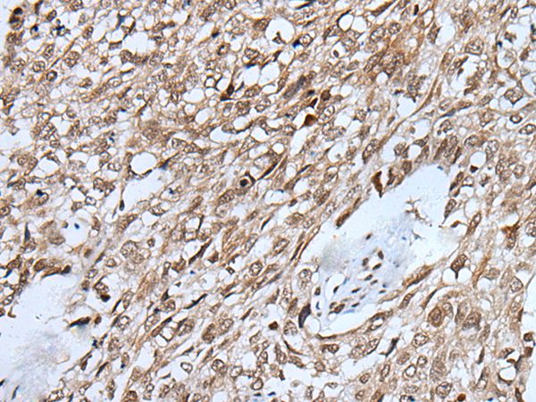 VCX Antibody